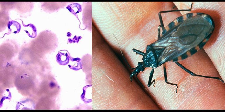 Enfermedad de Chagas