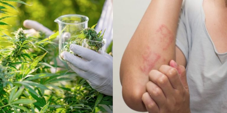 Compuesto de cannabis útil para combatir enfermedades de la piel