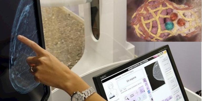 Google avanza inteligencia artificial vs cáncer