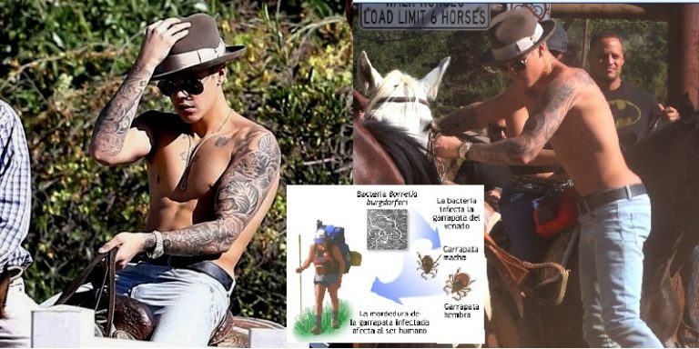 Justin Bieber, enfermedad de Lyme