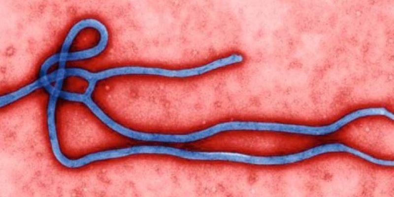 Virus del ébola podría combatir tumores cerebrales
