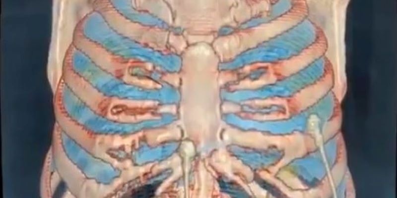 Vídeo en 3D muestra los efectos del Covid-19 en los pulmones