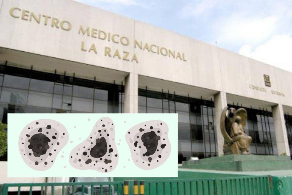 Fallece Gregorio, primer caso sospechoso de “hongo negro” en Edomex