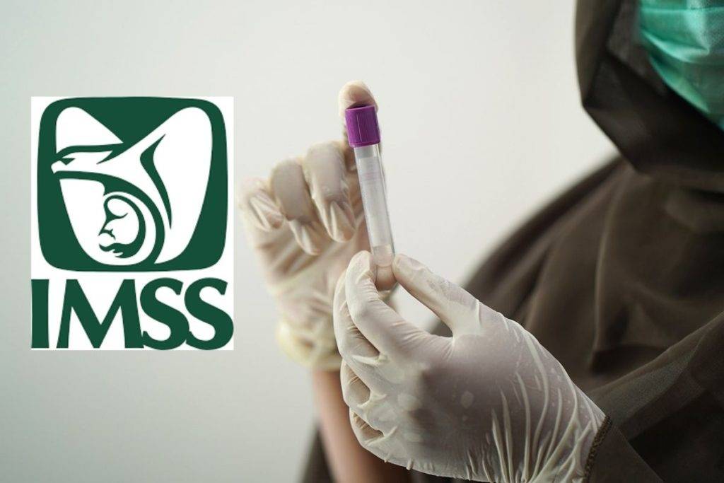 IMSS descarta caso de hongo negro en paciente de Edomex