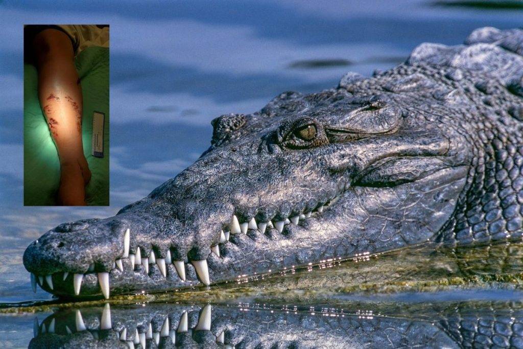 Cocodrilo de más de 3 metros ataca a joven en Puerto Vallarta