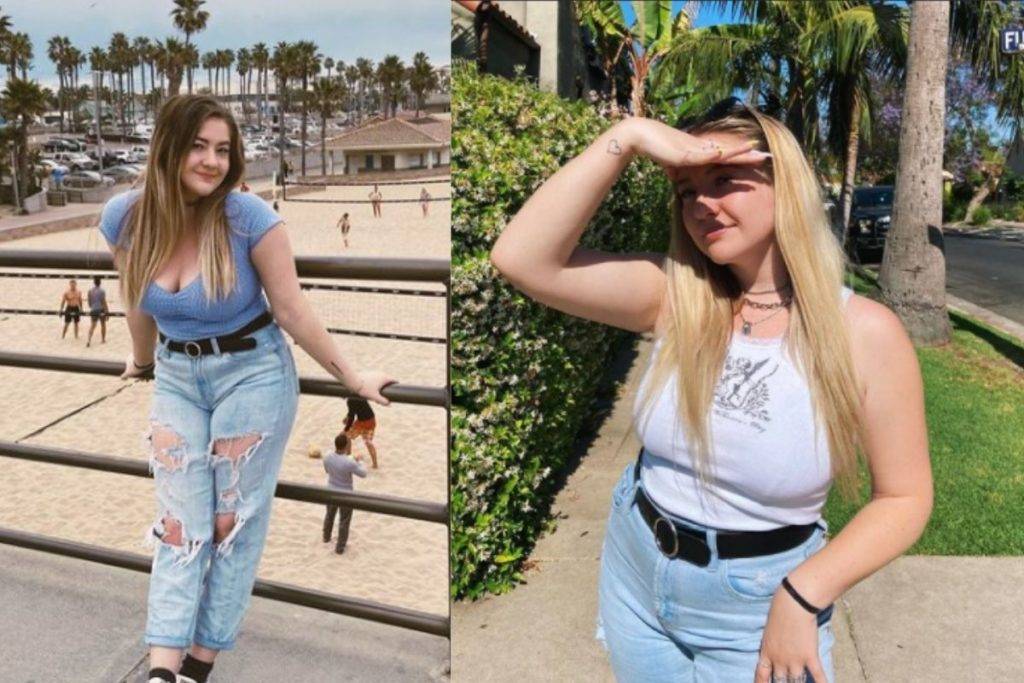 Mujer se somete a cirugía para reducir el tamaño de sus senos y le vuelven a crecer