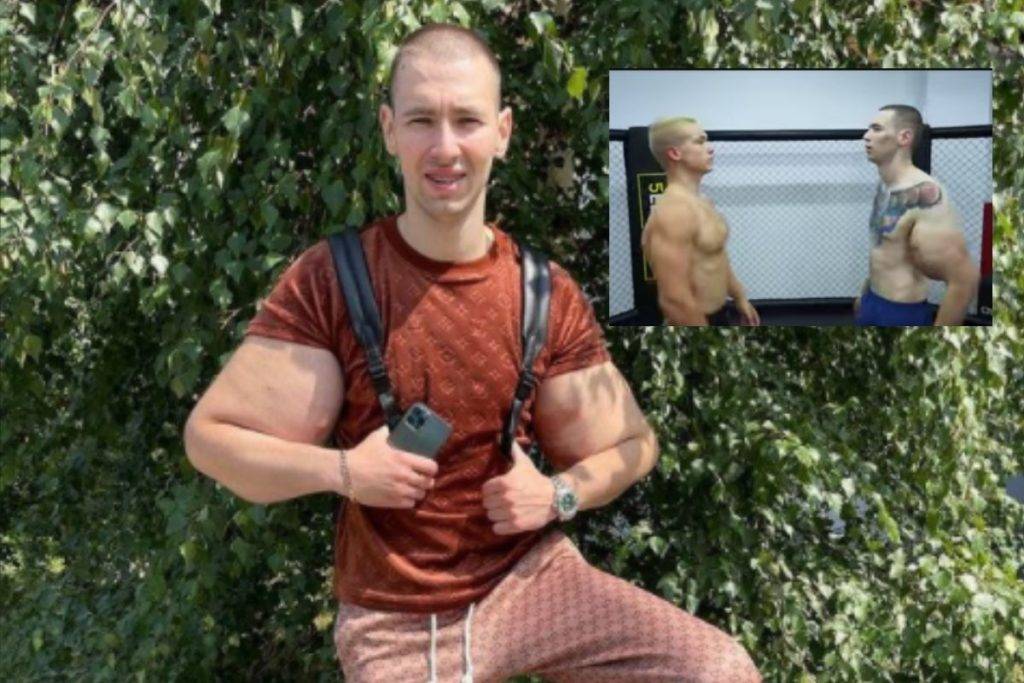 Brazos de joven conocido como el ‘Popeye ruso’ explotan durante combate