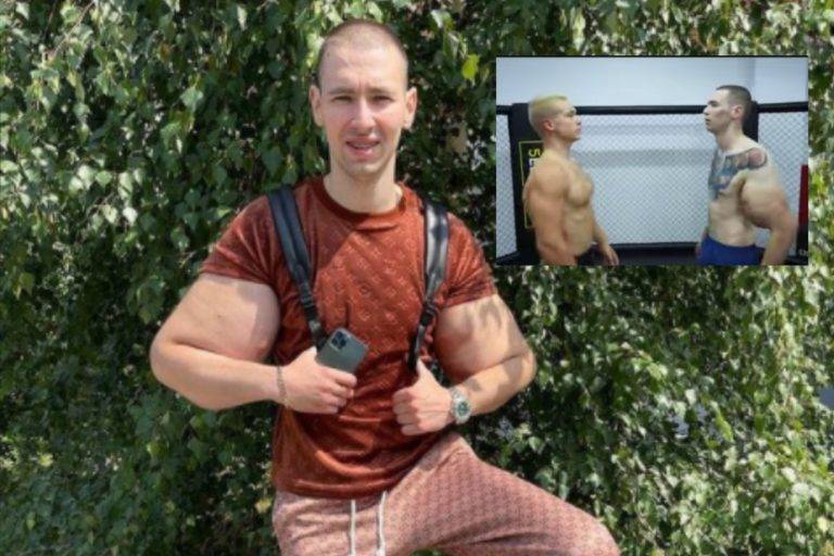Brazos de joven conocido como el ‘Popeye ruso’ explotan durante combate