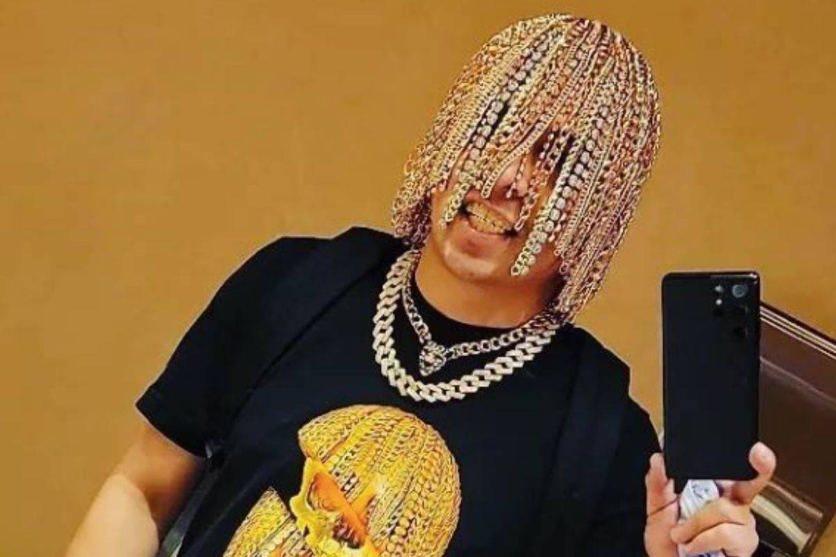 Rapero mexicano se implanta cadenas de oro en la cabeza como si fueran cabello