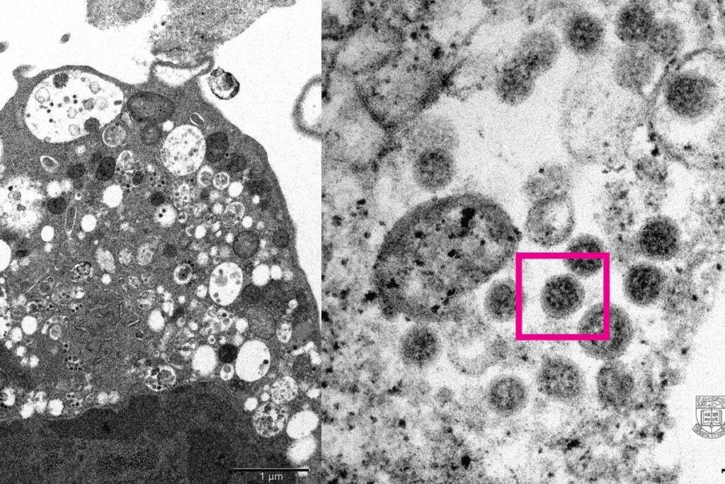 Científicos logran ‘retratar’ a la nueva variante Ómicron