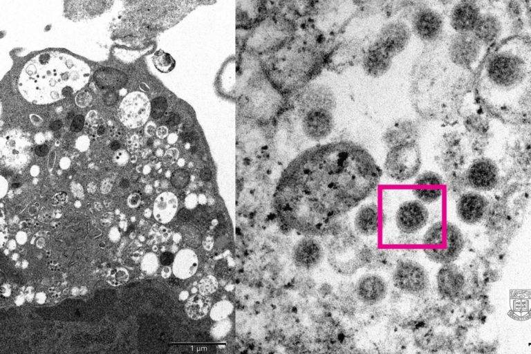 Científicos logran ‘retratar’ a la nueva variante Ómicron