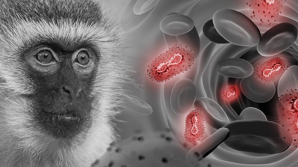 México reporta 91 casos de viruela del mono; no hay muertes 