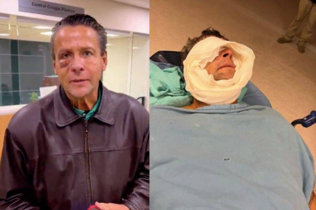 Alfredo Adame comparte impactantes imágenes de su cirugía tras golpiza que  sufrió - RegeneraciónMX