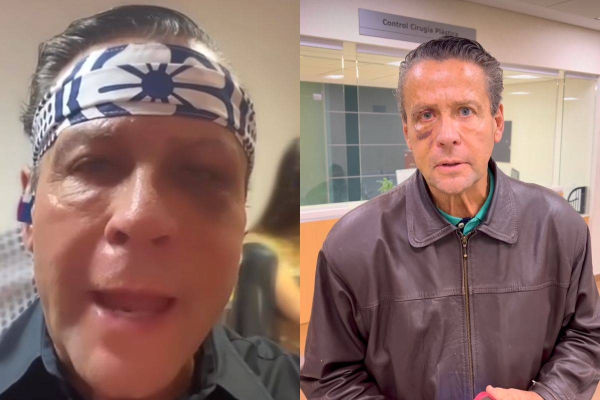 Alfredo Adame cuenta de los daños irreparables que sufrió su ojo tras