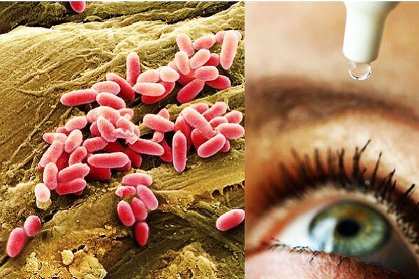 EE.UU: Alerta por gotas para ojos con bacteria Pseudomonas aeruginosa