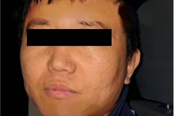 Zhi Dong objetivo prioritario de EE.UU. Proveedor de precursores químicos a cárteles. Fugado en julio pasado por túnel de su casa en Tlalpan