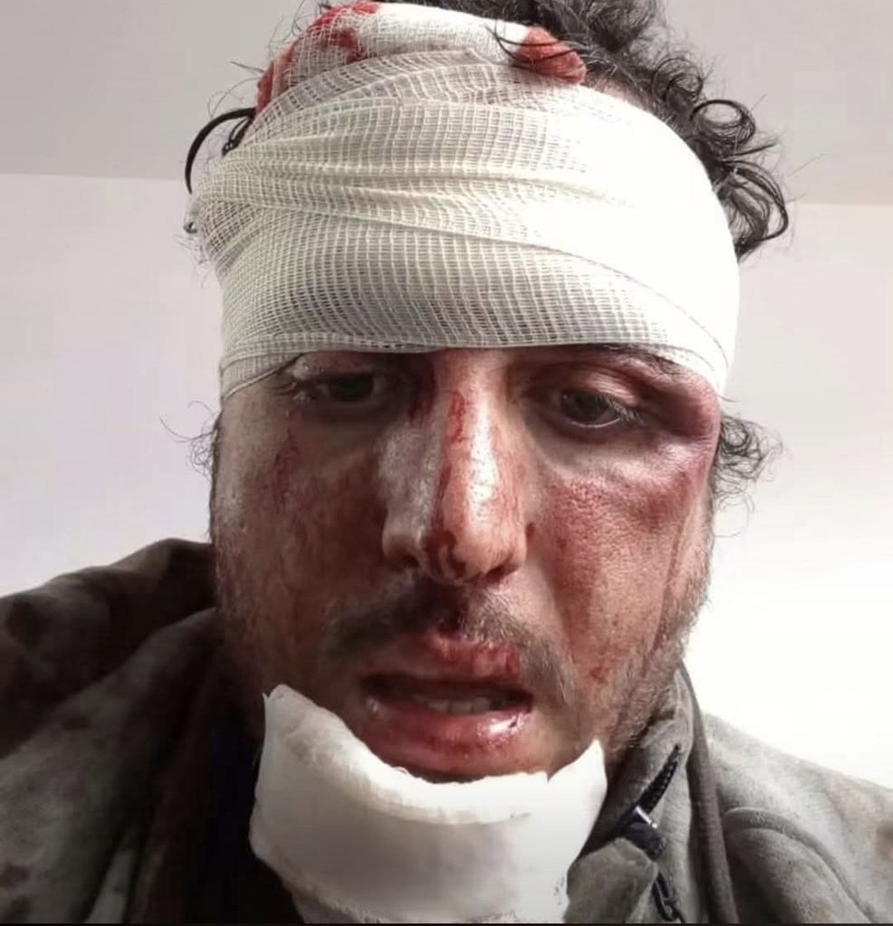 Detenido de la manifestación por agua limpia muestra sus heridas dentro de Casa Jalisco después de ser sustraído por elementos policiacos.